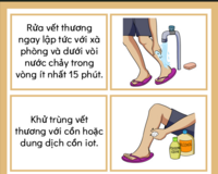 Bite Management Vietnamese